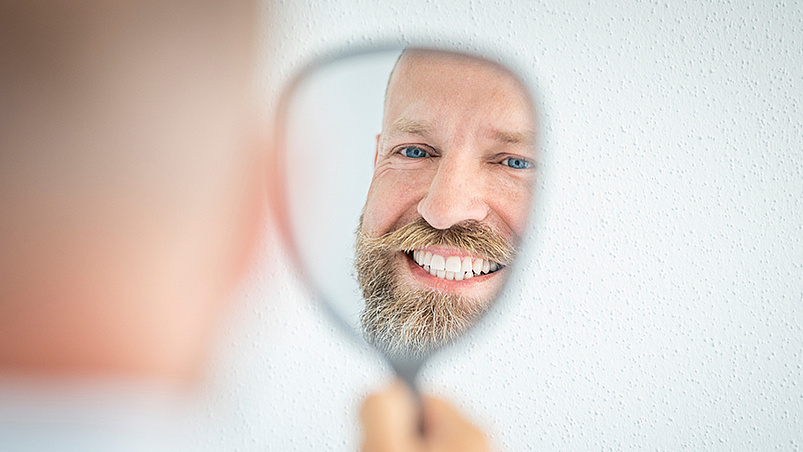 Veneers